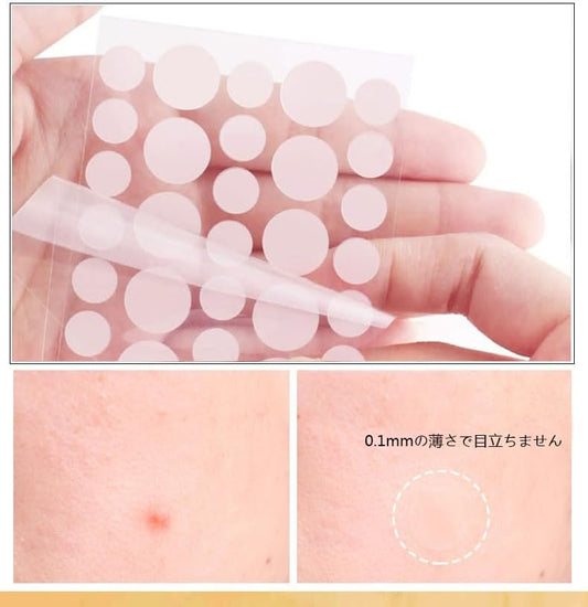 point patch acne patch Spot patches are easy to cover Thin 144 pieces