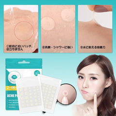 Spot Patch, Thin, 264/528 Pieces, Sensitive Skin, Rough Skin Care, Pimple Patch, Large Capacity, Day and Night Use (264)