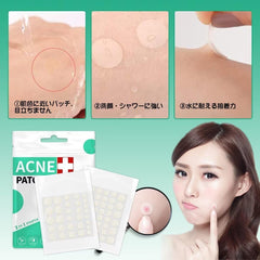 264/528 Piece Spot Patch Care, Thin, Sensitive Skin, Rough Skin Care, For Daytime + Night, Large Capacity, Pimple Patch (264)