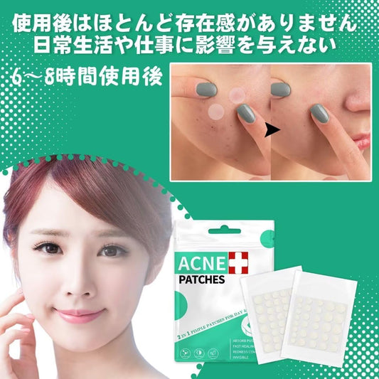 264/528 Piece Spot Patch Care, Thin, Sensitive Skin, Rough Skin Care, For Daytime + Night, Large Capacity, Pimple Patch (264)