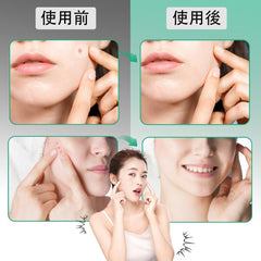 264/528 Piece Spot Patch Care, Thin, Sensitive Skin, Rough Skin Care, For Daytime + Night, Large Capacity, Pimple Patch (264)