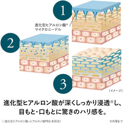 IC.U HA Micro Patch EX 2 Sheets (1 Dose)