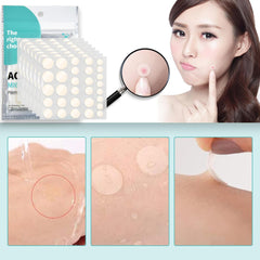 pimple patch acne pack acne patch spot patch skin care day + night use (240)